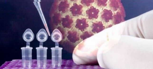 디진 검사를 이용한 HPV 진단