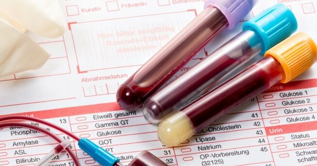 인유두종바이러스 혈액검사
